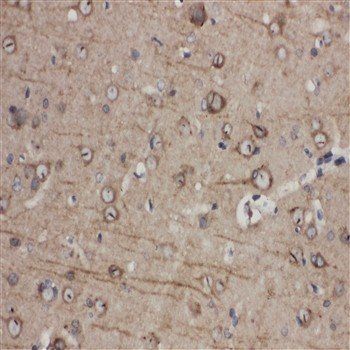 Eph receptor A1/EPHA1 Antibody