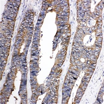 Eph receptor A1/EPHA1 Antibody