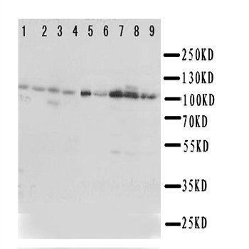 Eph receptor A1/EPHA1 Antibody