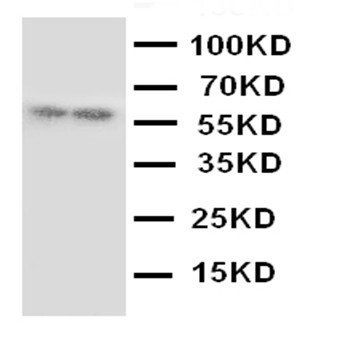 GABA A Receptor alpha 1/GABRA1 Rabbit Polyclonal Antibody