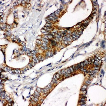Laminin gamma 1/LAMC1 Rabbit Polyclonal Antibody