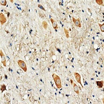 Anti-Dopamine Receptor D3/DRD3 Antibody