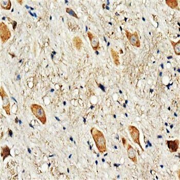 Dopamine Receptor D3/DRD3 Antibody