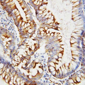 Anti-SPARC Antibody