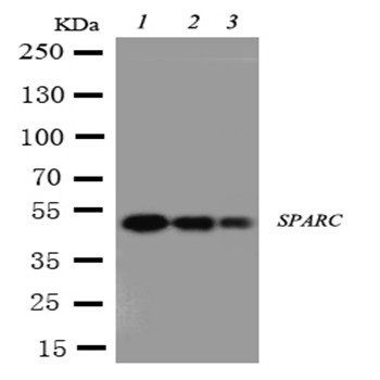 Anti-SPARC Antibody