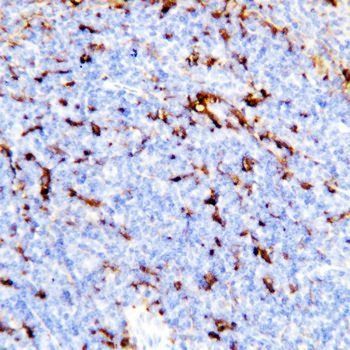 Anti-TREM1 Antibody