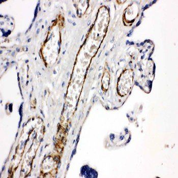 Anti-CD168/HMMR Antibody