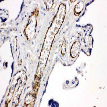 CD168/HMMR Antibody