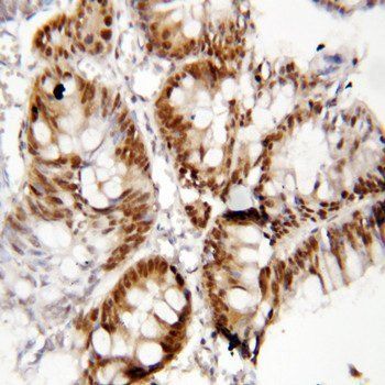 Anti-Forkhead box protein P1 FOXP1 Antibody
