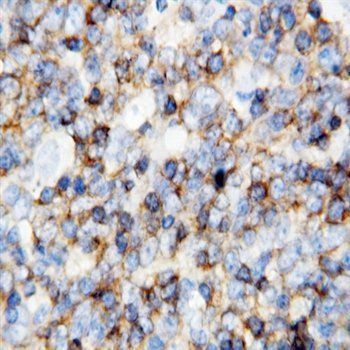 Anti-CD45/PTPRC Antibody