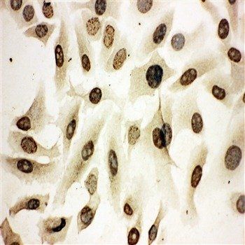 Anti-Homeobox protein Hox-A4 HOXA4 Antibody