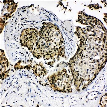 Homeobox protein Hox-A4 HOXA4 Antibody