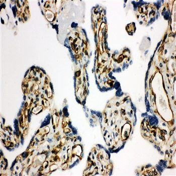 Anti-HSD17B2 Antibody