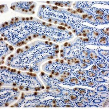 Anti-Hsp105/HSPH1 Antibody