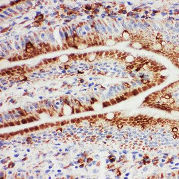 Anti-Hsp105/HSPH1 Antibody