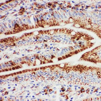 Hsp105/HSPH1 Antibody