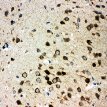 Anti-Integrin alpha 3/ITGA3 Antibody