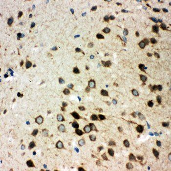 Integrin alpha 3/ITGA3 Antibody