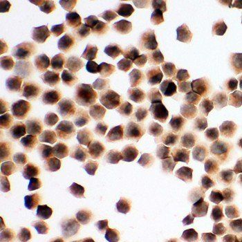 Anti-TIM 1/HAVCR1 Antibody