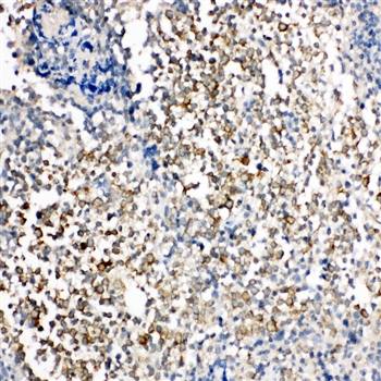 TIM 1/HAVCR1 Antibody