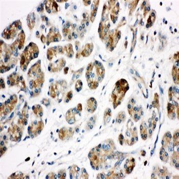 Anti-Kallikrein 1/KLK1 Antibody