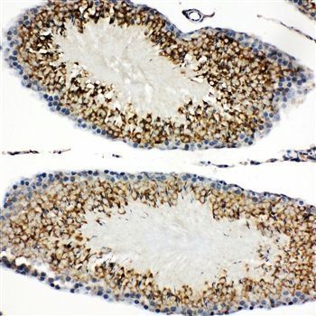 Anti-TIM 1/HAVCR1 Antibody