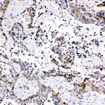 Anti-MRP1/ABCC1 Antibody