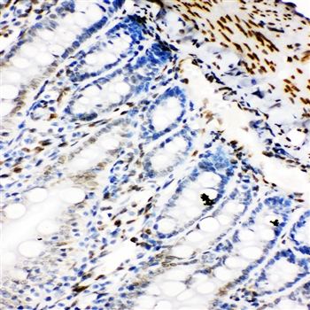 Anti-Lamin B2/LMNB2 Antibody