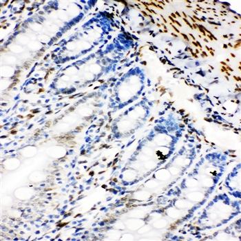 Lamin B2/LMNB2 Antibody