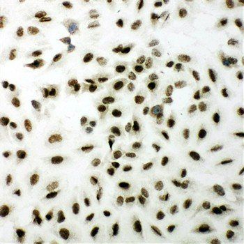 Anti-XRCC1 Antibody