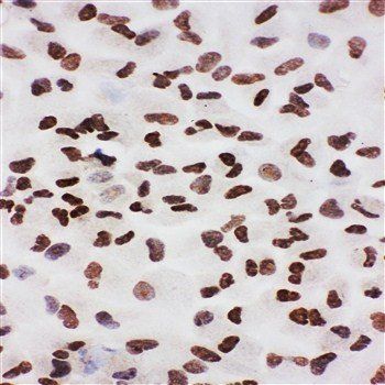 Anti-Ku70/XRCC6 Antibody