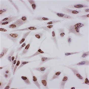 Anti-Ku70/XRCC6 Antibody