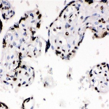 Anti-Ku70/XRCC6 Antibody