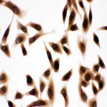 Anti-Bub3 Antibody