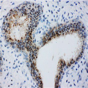 Bub3 Antibody