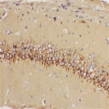 Anti-5HT1A Receptor/HTR1A Antibody