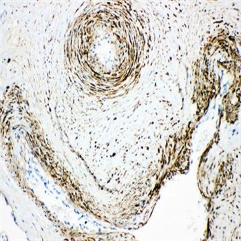 Anti-Monoamine Oxidase A/MAOA Antibody