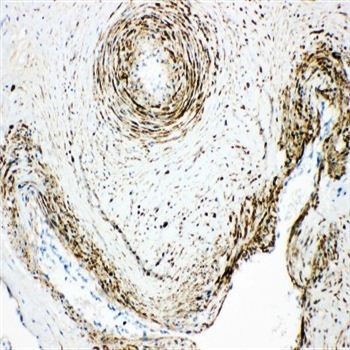 Monoamine Oxidase A/MAOA Antibody