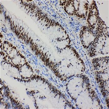 MCM2 Rabbit Polyclonal Antibody