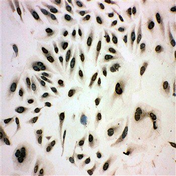 Anti-MCM3 Antibody