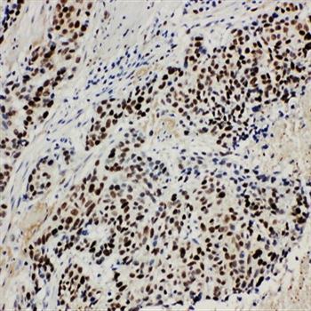 Anti-MCM3 Antibody