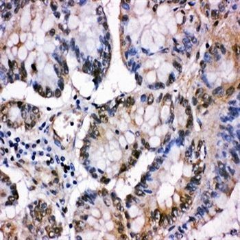 Anti-MCM5 Antibody