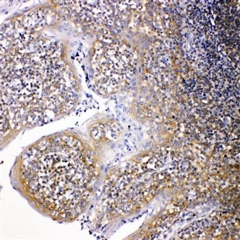 Anti-NOX2/gp91phox/CYBB Antibody