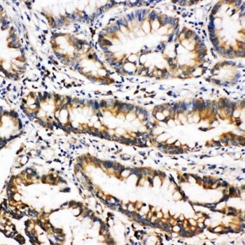 Oncostatin M/OSM Rabbit Polyclonal Antibody