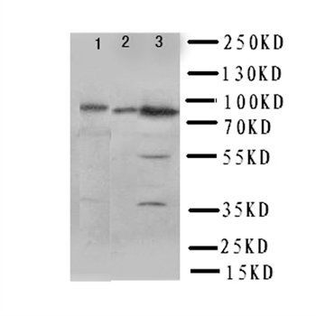 PI 3 Kinase p85 beta/PIK3R2 Rabbit Polyclonal Antibody