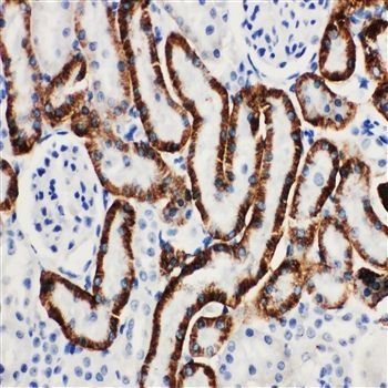 SLC22A6 Antibody