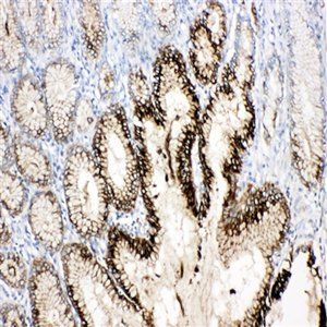 Anti-Estrogen Inducible Protein pS2/TFF1 Antibody