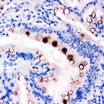 Anti-Estrogen Inducible Protein pS2/TFF1 Antibody