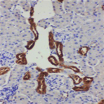 Kallikrein 1/KLK1 Antibody