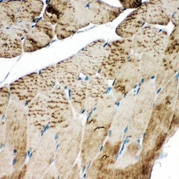 Anti-SERCA1 ATPase/ATP2A1 Antibody
